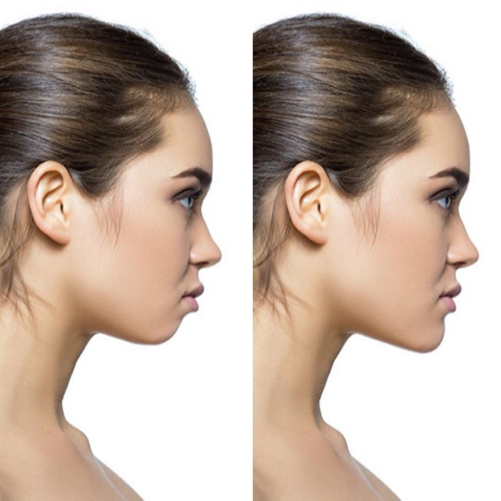 Makeup Contouring & Jawline Posture